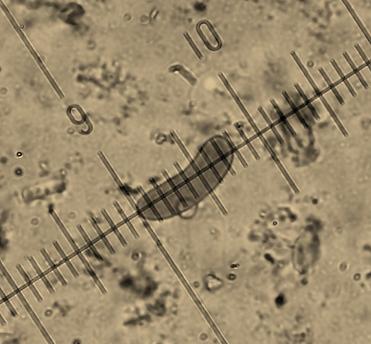 Vuilleminia comedens